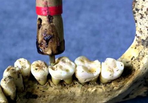 dinti de la Mehrgarh